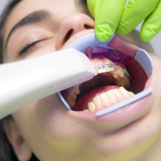 met dekking voor orthodontist zonder wachttijd (2022